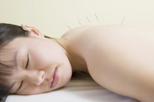 A skilled acupuncturist will make a treatment relaxing, therapeutic and painless