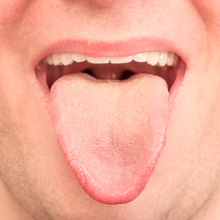 Tongue diagnosis