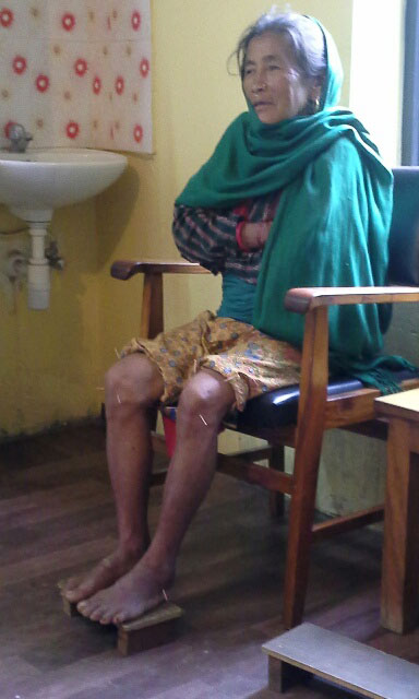 Local villager receiving acupuncture for knee pain